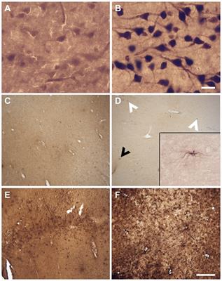 Comparison of histological procedures and antigenicity of human post-mortem brains fixed with solutions used in gross anatomy laboratories